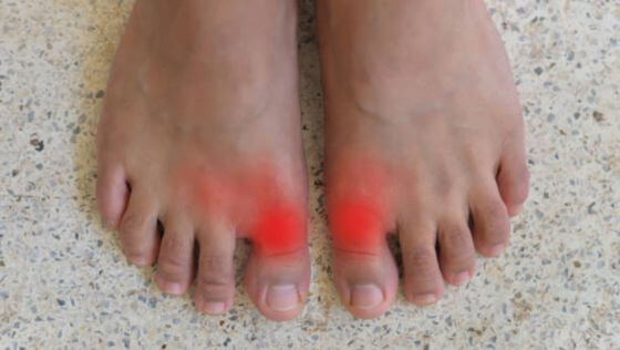 Common Injuries Feet Hurt When Jumping Rope